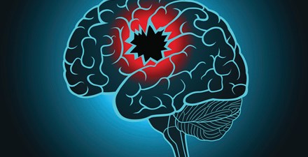 A brain with an injury.