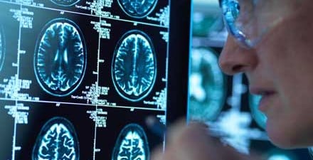 A neurologic physical therapist looks at a person's brain scans.